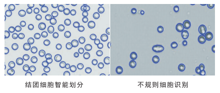 細胞計數(shù)儀細胞劃分圖片